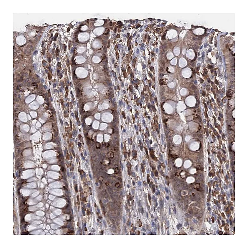 Atlas Antibodies Anti-TBC1D12 Antibody
