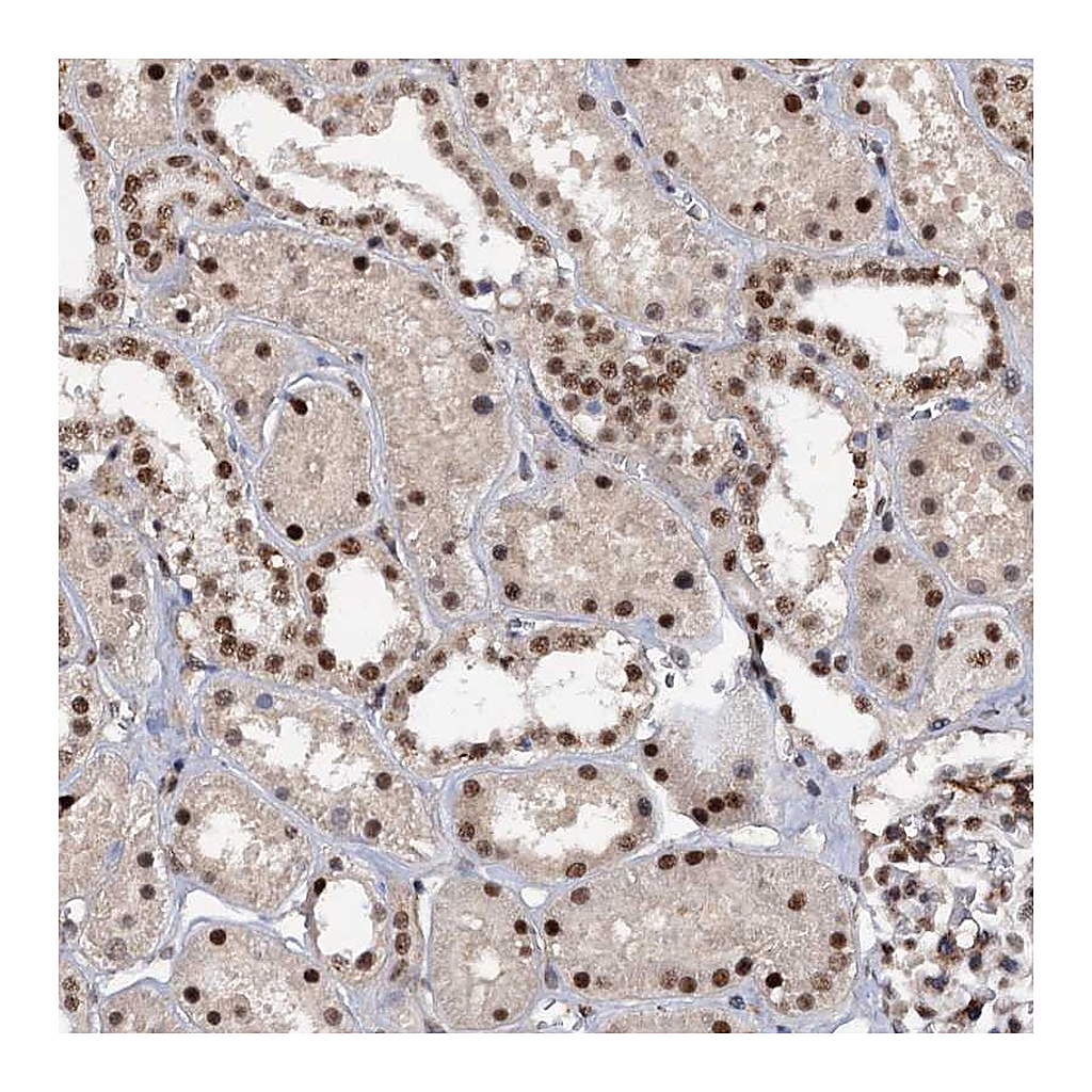 Atlas Antibodies Anti-TBC1D12 Antibody