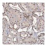 Atlas Antibodies Anti-TBC1D12 Antibody