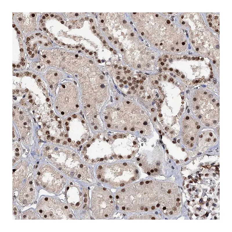 Atlas Antibodies Anti-TBC1D12 Antibody