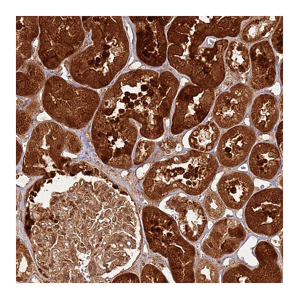 Atlas Antibodies Anti-TBC1D13 Antibody