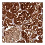 Atlas Antibodies Anti-TBC1D13 Antibody