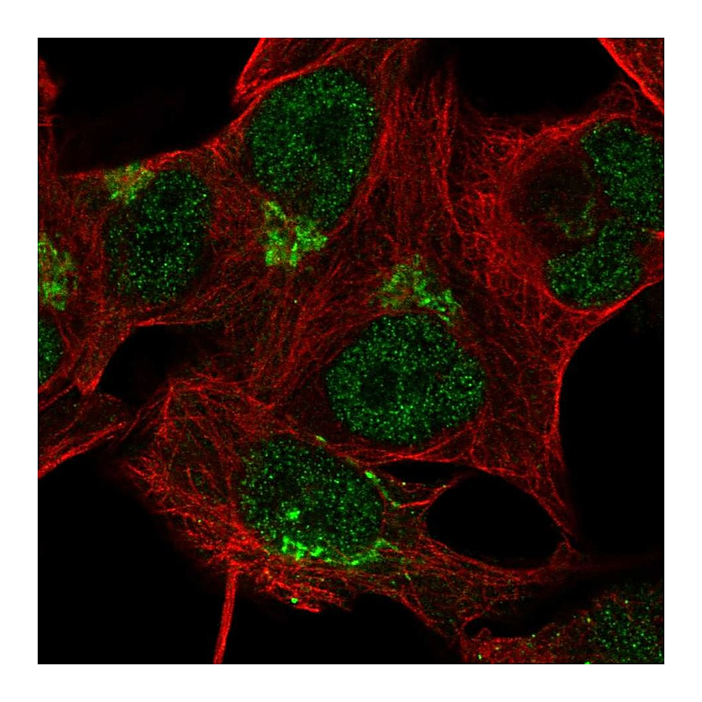 Atlas Antibodies Anti-TBC1D14 Antibody