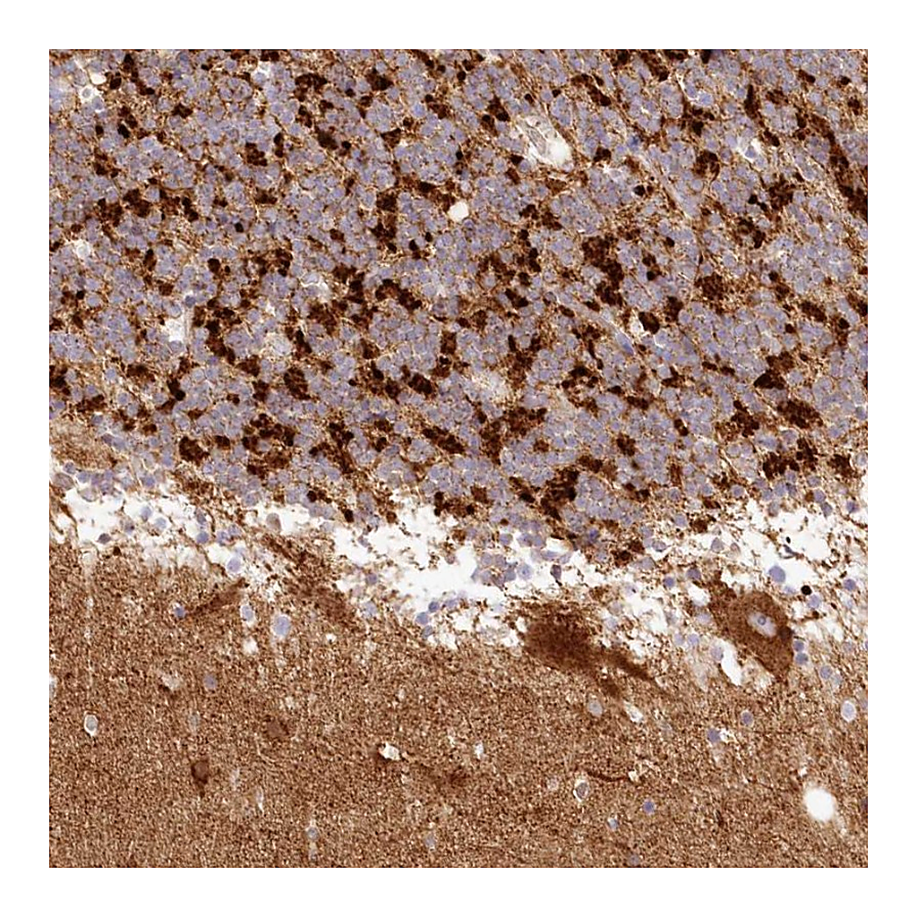 Atlas Antibodies Anti-TBC1D14 Antibody