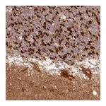 Atlas Antibodies Anti-TBC1D14 Antibody