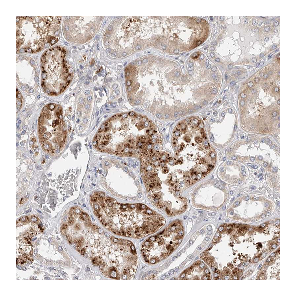 Atlas Antibodies Anti-TBC1D16 Antibody