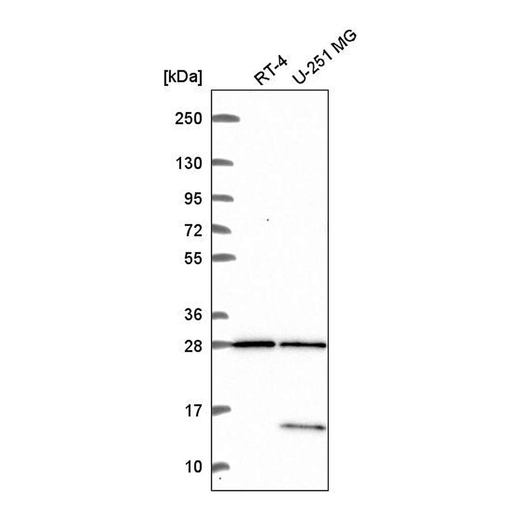 Atlas Antibodies Anti-TBC1D16 Antibody