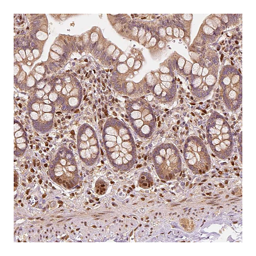 Atlas Antibodies Anti-TBC1D17 Antibody