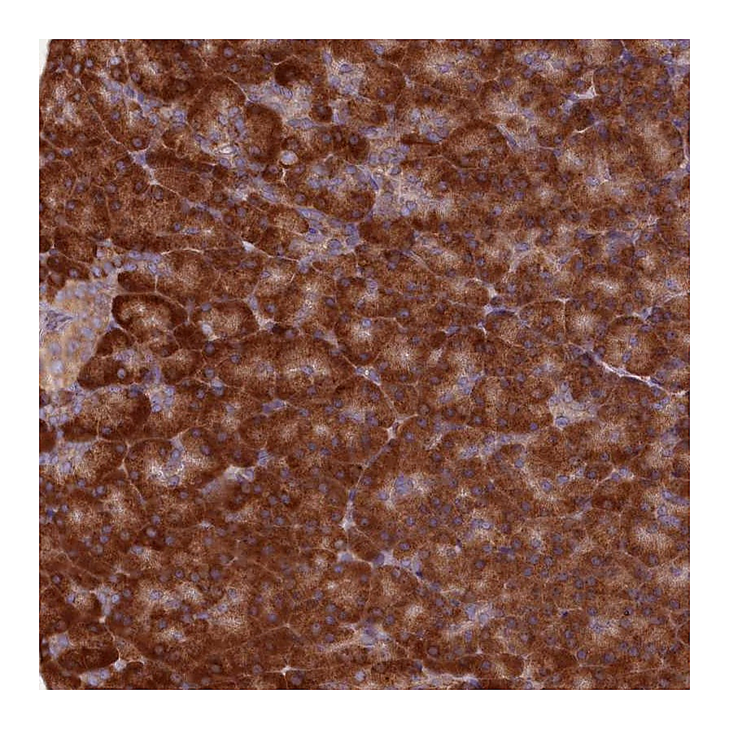 Atlas Antibodies Anti-TBC1D19 Antibody