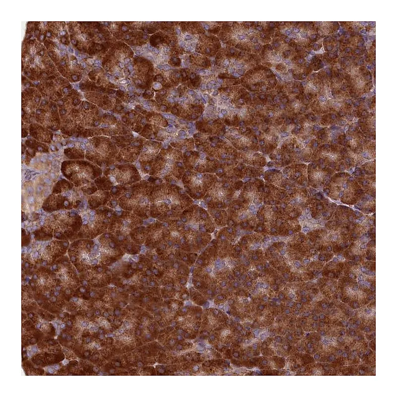Atlas Antibodies Anti-TBC1D19 Antibody
