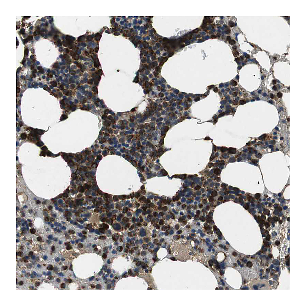 Atlas Antibodies Anti-TBC1D15 Antibody