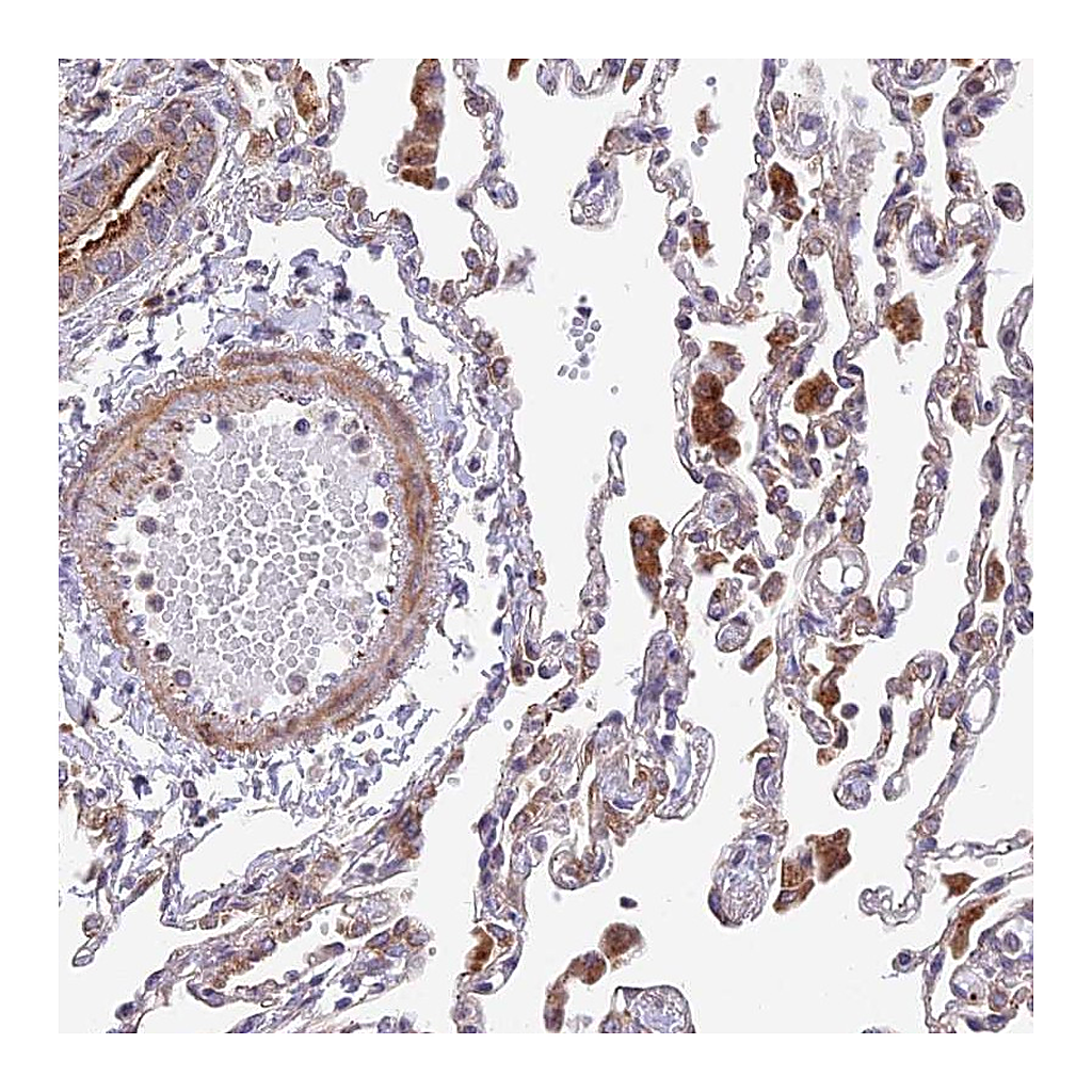 Atlas Antibodies Anti-TBC1D20 Antibody