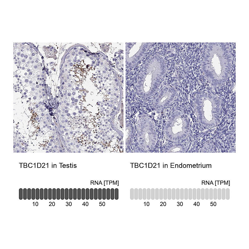 Atlas Antibodies Anti-TBC1D21 Antibody