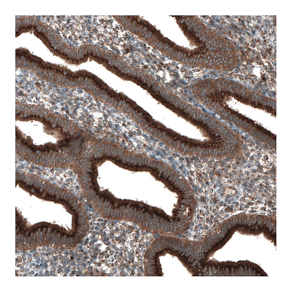 Atlas Antibodies Anti-TBC1D23 Antibody