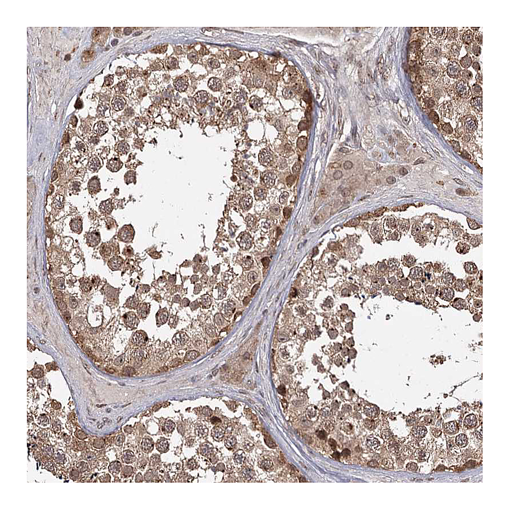 Atlas Antibodies Anti-TBC1D23 Antibody