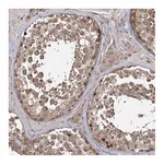 Atlas Antibodies Anti-TBC1D23 Antibody