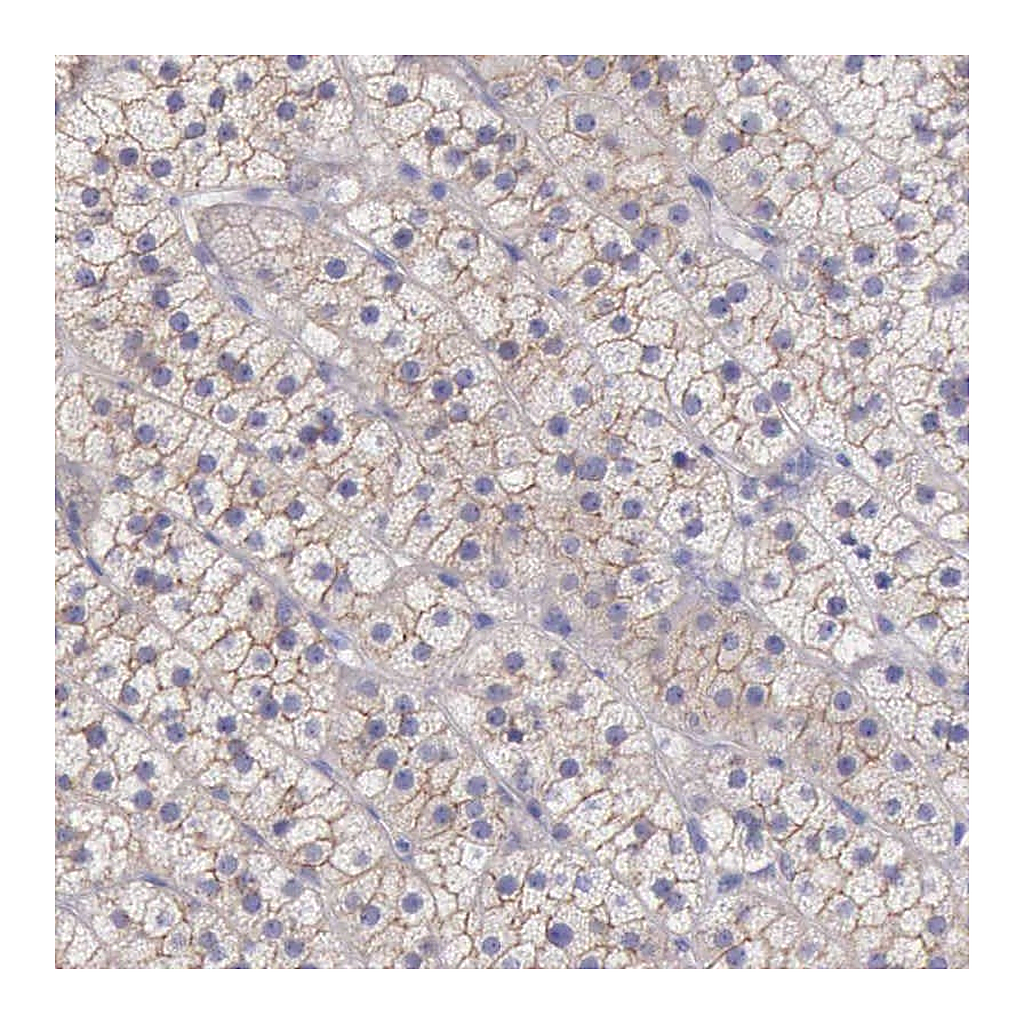 Atlas Antibodies Anti-TBC1D22A Antibody