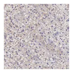 Atlas Antibodies Anti-TBC1D22A Antibody
