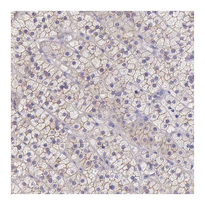 Atlas Antibodies Anti-TBC1D22A Antibody