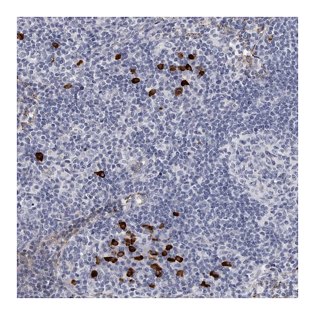 Atlas Antibodies Anti-TBC1D22B Antibody