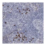 Atlas Antibodies Anti-TBC1D22B Antibody