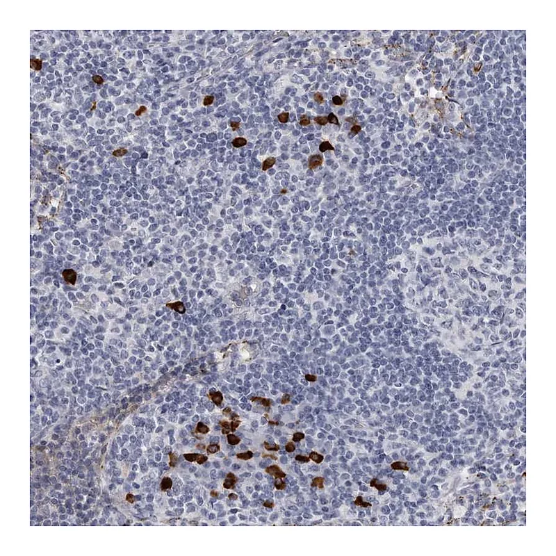 Atlas Antibodies Anti-TBC1D22B Antibody