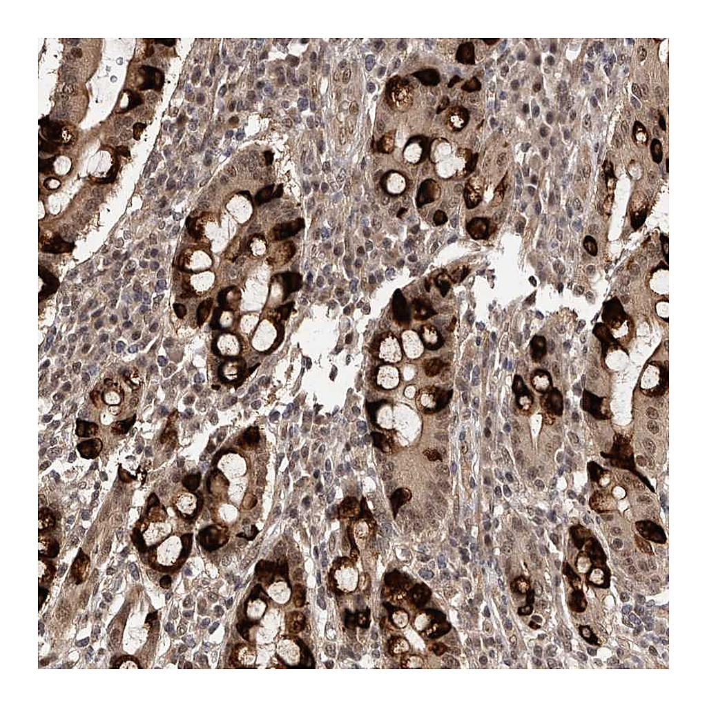 Atlas Antibodies Anti-TBC1D22B Antibody