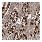 Atlas Antibodies Anti-TBC1D22B Antibody
