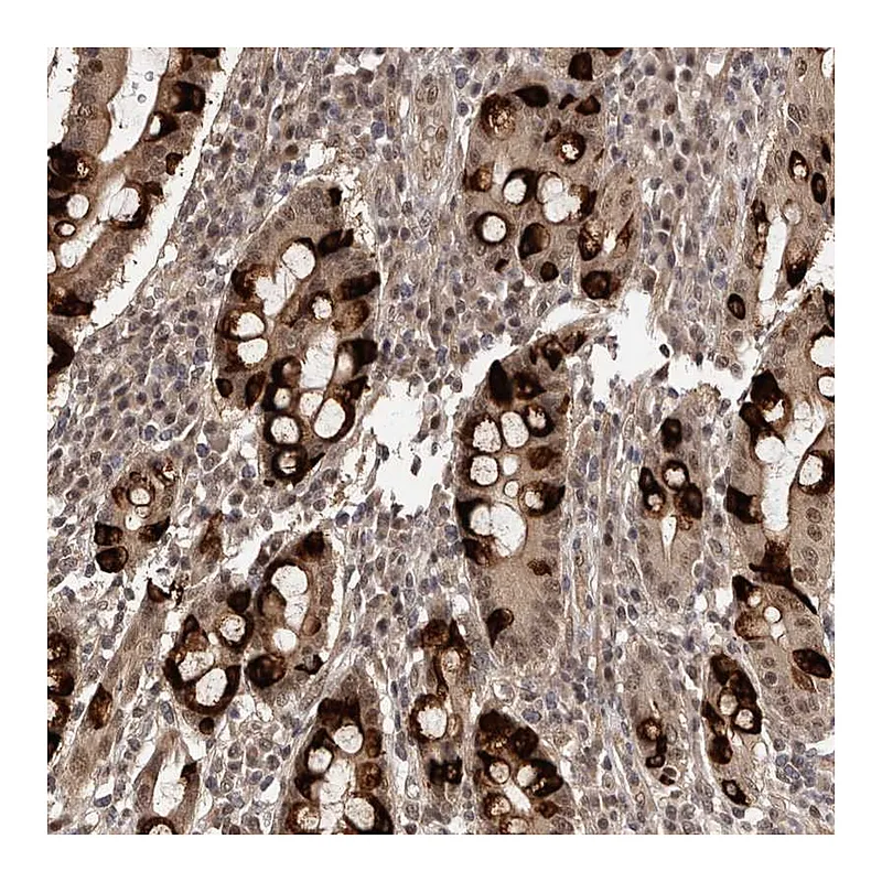 Atlas Antibodies Anti-TBC1D22B Antibody
