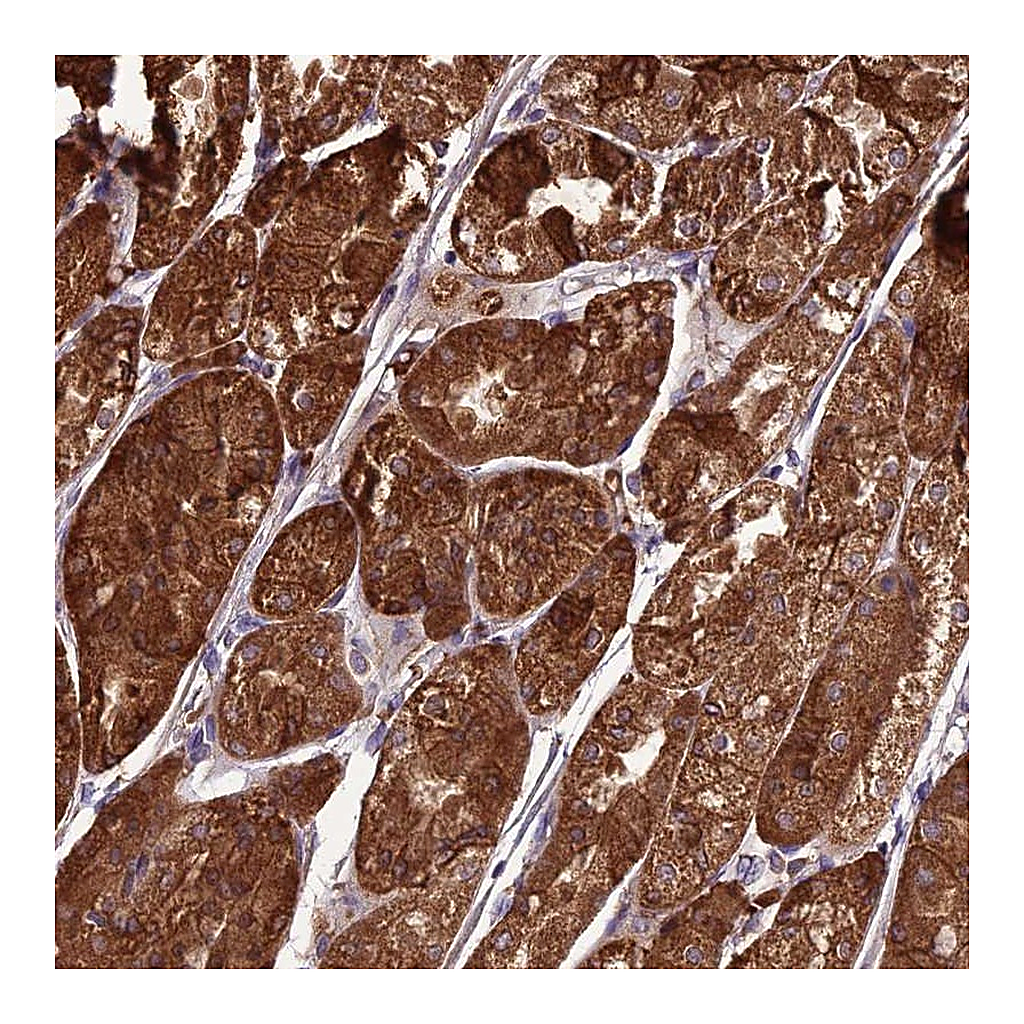Atlas Antibodies Anti-TBC1D24 Antibody