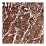 Atlas Antibodies Anti-TBC1D24 Antibody