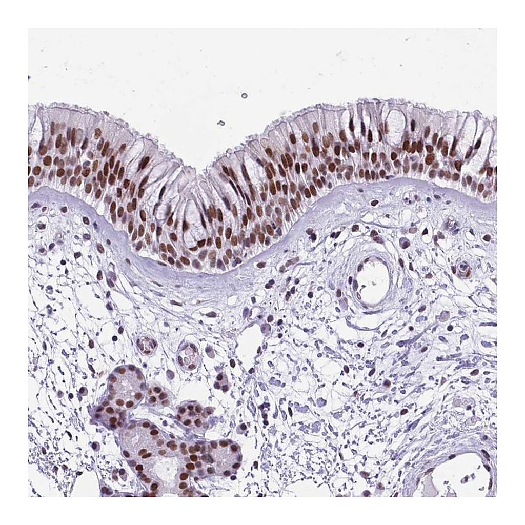 Atlas Antibodies Anti-TBC1D26 Antibody