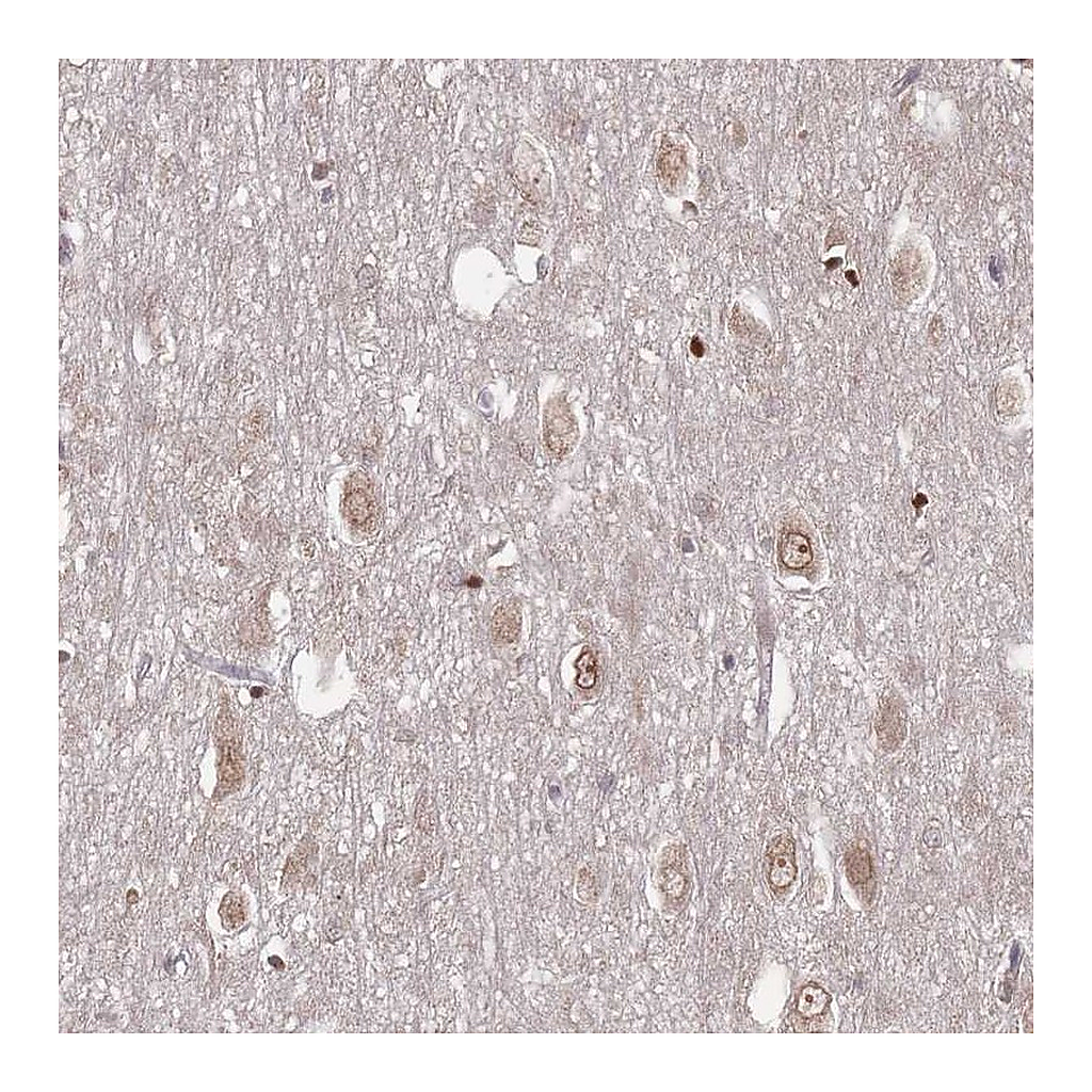 Atlas Antibodies Anti-TBC1D25 Antibody
