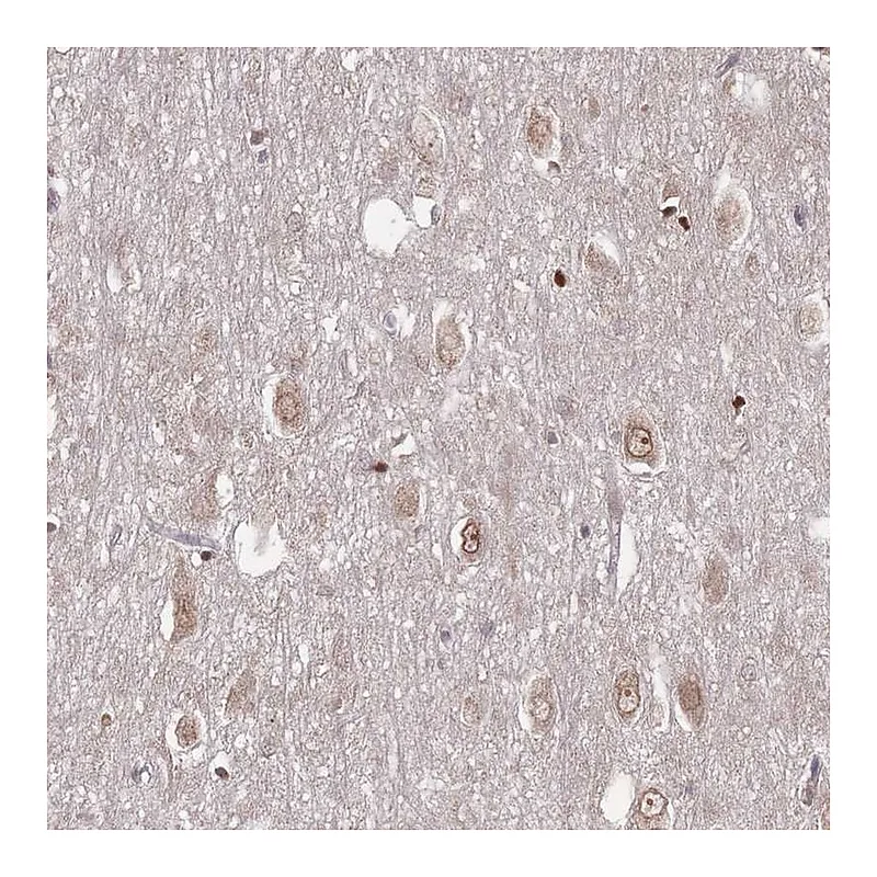 Atlas Antibodies Anti-TBC1D25 Antibody