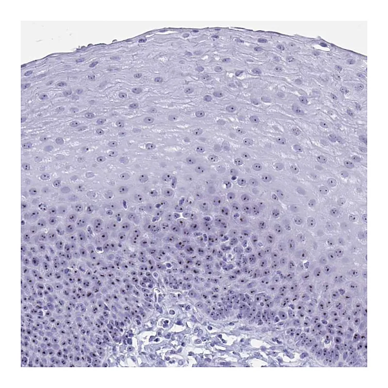 Atlas Antibodies Anti-TBC1D29 Antibody