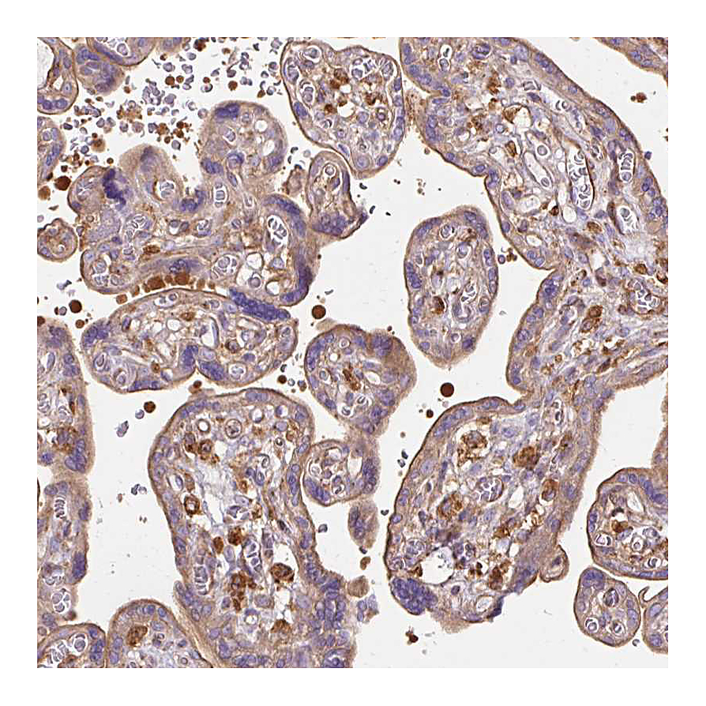 Atlas Antibodies Anti-TBC1D2B Antibody