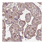Atlas Antibodies Anti-TBC1D2B Antibody