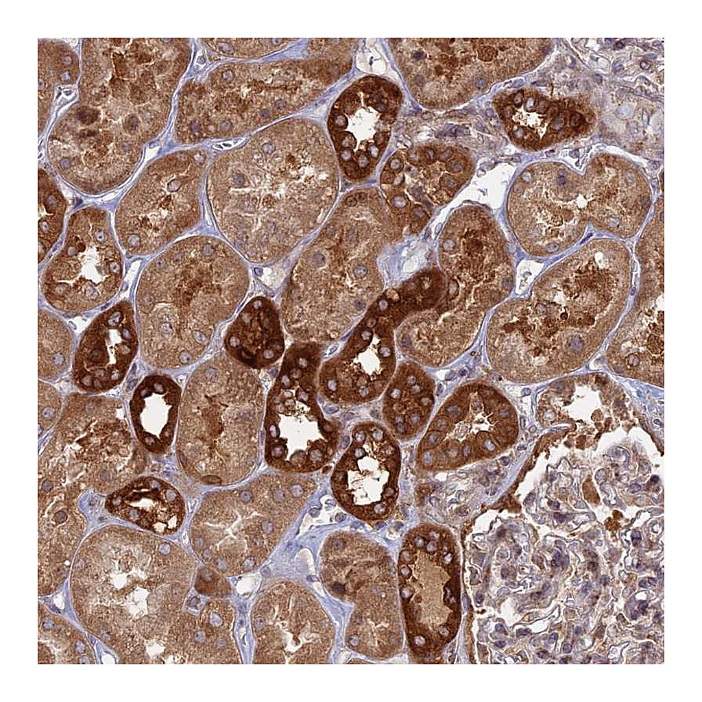 Atlas Antibodies Anti-TBC1D30 Antibody