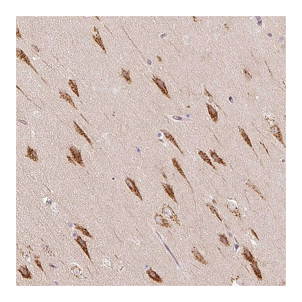 Atlas Antibodies Anti-TBC1D2B Antibody