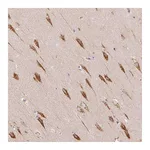 Atlas Antibodies Anti-TBC1D2B Antibody