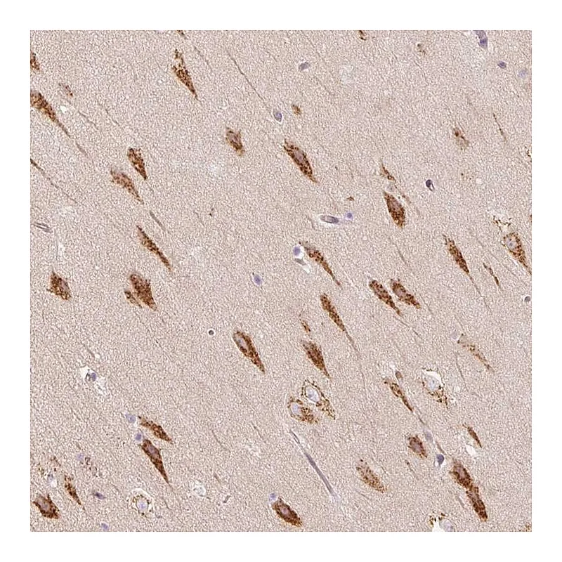 Atlas Antibodies Anti-TBC1D2B Antibody