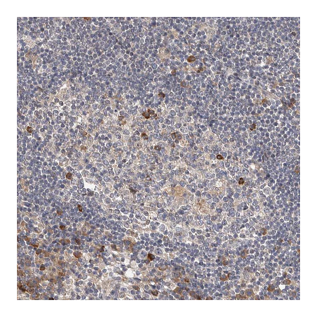 Atlas Antibodies Anti-TBC1D31 Antibody