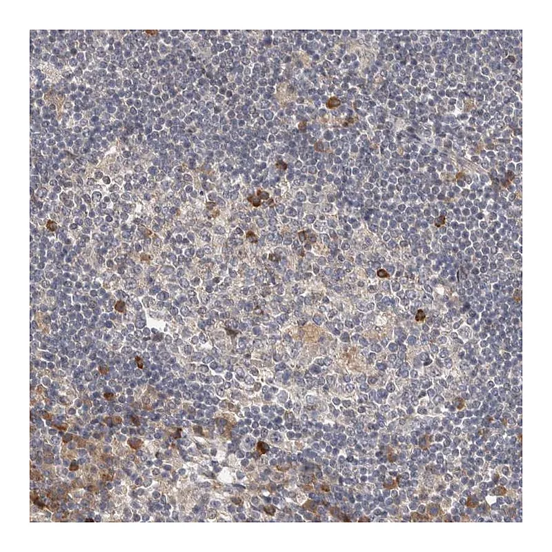 Atlas Antibodies Anti-TBC1D31 Antibody