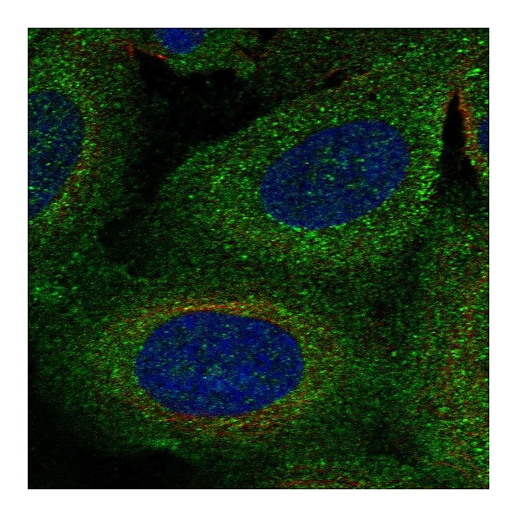 Atlas Antibodies Anti-TBC1D2B Antibody