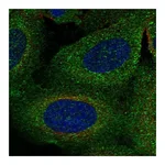 Atlas Antibodies Anti-TBC1D2B Antibody
