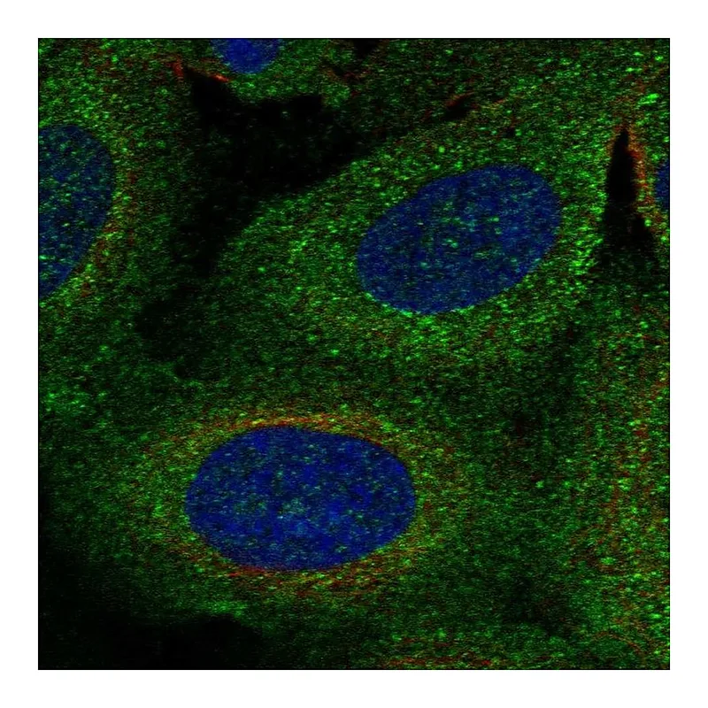 Atlas Antibodies Anti-TBC1D2B Antibody