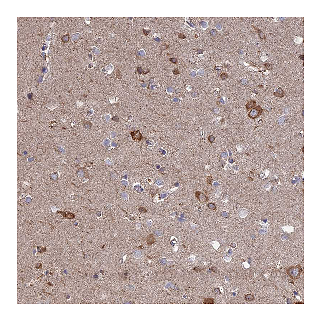 Atlas Antibodies Anti-TBC1D30 Antibody