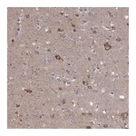 Atlas Antibodies Anti-TBC1D30 Antibody