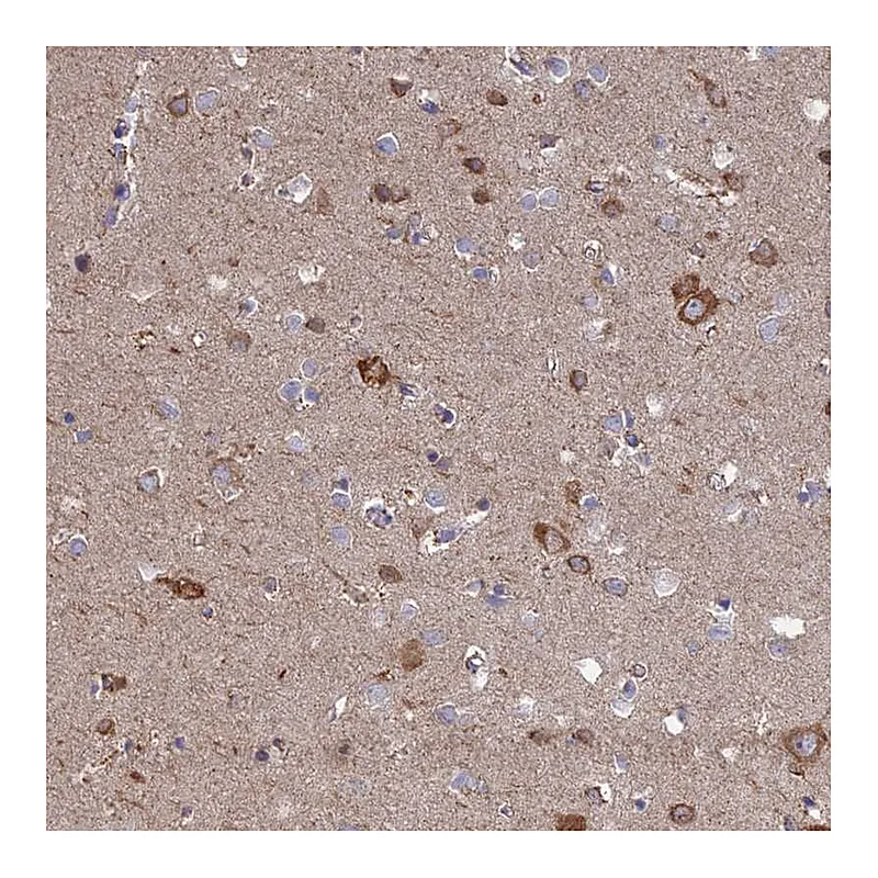 Atlas Antibodies Anti-TBC1D30 Antibody