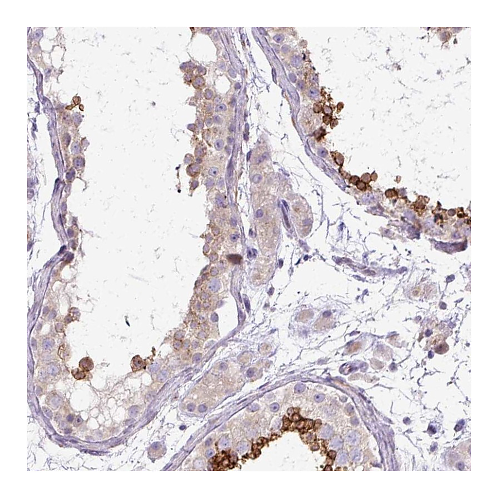 Atlas Antibodies Anti-TBC1D3L Antibody